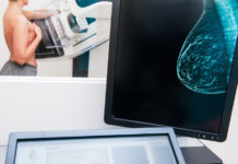 3 consejos para el diagnóstico precoz del cáncer de mama