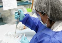 2019: Más de 5 mil casos de VIH confirmados por ISP VIH SIDA