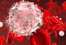 Cáncer de la sangre: La importancia de no invisibilizar la enfermedad en tiempos de COVID-19 Día Mundial del Cáncer de la Sangre