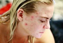 problemas dermatológicos