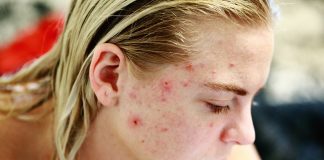 problemas dermatológicos