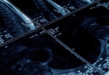 Resonador magnético de última generación permite disminuir hasta en un 40% la duración de los exámenes y obtener resultados más precisos