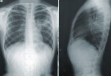 Más de 400 médicos están usando una plataforma para detectar enfermedades respiratorias y de rastros de COVID19 en segundos Más de 400 médicos están usando una plataforma para detectar enfermedades respiratorias y de rastros de COVID19 en segundos