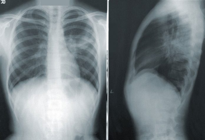 Más de 400 médicos están usando una plataforma para detectar enfermedades respiratorias y de rastros de COVID19 en segundos