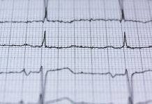 Antiinflamatorios podrían afectar seriamente tu corazón Antiinflamatorios podrían afectar seriamente tu corazón