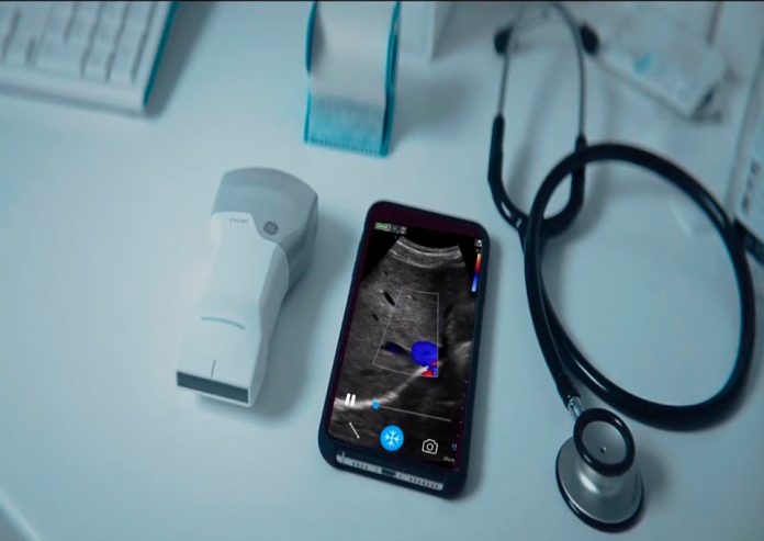 GE Healthcare revoluciona la atención de la salud con nuevo ultrasonido portátil de bolsillo