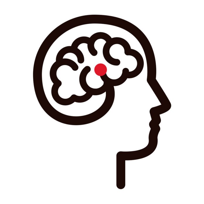 Agrupación de pacientes brinda apoyo fundamental a personas que han sufrido un ataque cerebrovascular Agrupación de pacientes brinda apoyo fundamental a personas que han sufrido un ataque cerebrovascular