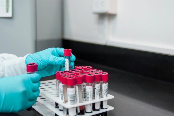 Por una baja de 60% Centro Metropolitano hace llamado a que las personas donen sangre