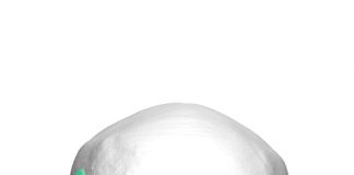 Startup chilena desarrolla implantes cráneo-faciales customizados con tecnología única