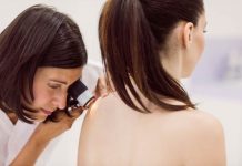 En Chile se diagnostican más de 800 casos de melanoma al año En Chile se diagnostican más de 800 casos de melanoma al año