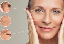 Sculptra - colágeno de la piel