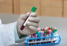 “Hemostasis Learning Essentials”: un programa educativo dedicado a la hemostasia Programa educativo de Hemostasia