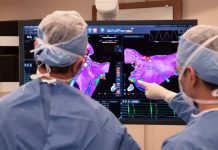 Fibrilación Auricular