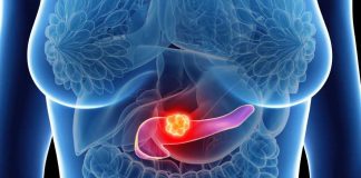 Los avances en el tratamiento contra el cáncer de páncreas brindan opciones y esperanza 
