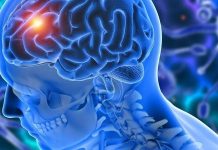 Investigadores de Mayo Clinic descubren que los antecedentes de cáncer o enfermedad de las arterias coronarias pueden reducir el riesgo de padecer demencia Investigadores de Mayo Clinic descubren que los antecedentes de cáncer o enfermedad de las arterias coronarias pueden reducir el riesgo de padecer demencia