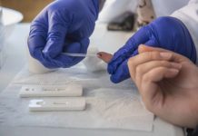 VIH Sida en Chile Urgencia por detectar nuevos casos