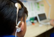 Implante coclear en Chile 40 años recuperando la audición de pacientes con sordera profunda