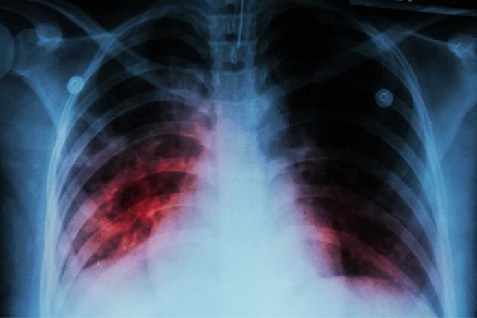 TUBERCULOSIS: LA OLVIDADA ENFERMEDAD INFECCIOSA QUE DESTRONÓ AL COVID-19 COMO LA PRINCIPAL AMENAZA SANITARIA EN EL MUNDO