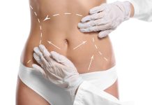 La importancia de tener un buen postquirúrgico tras la mini Lipo