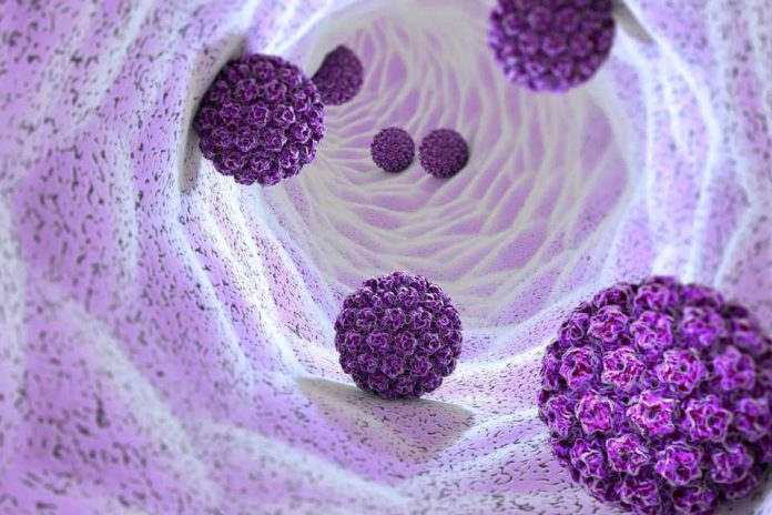 La infección por el VPH puede causar cáncer de boca y de garganta