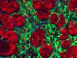 Nueva generación de microgeles con nanopartículas de oro para tratar tumores