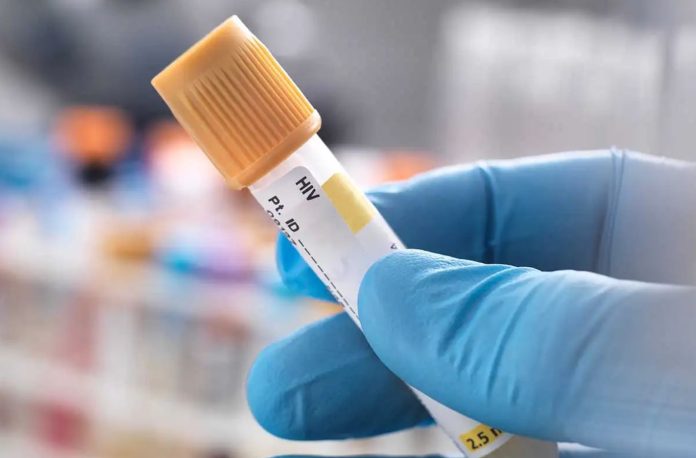 ¿Cómo se detectan las Enfermedades de Transmisión Sexual?