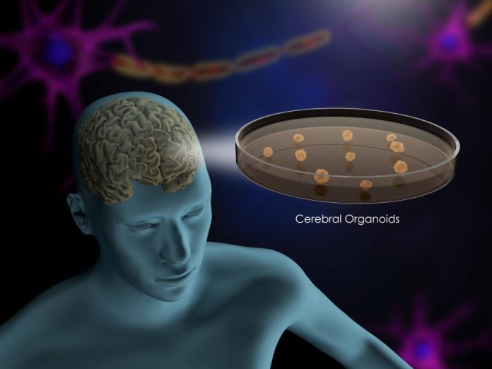 El estudio de “minicerebro” de Mayo Clinic revela un posible vínculo clave con el trastorno del espectro autista