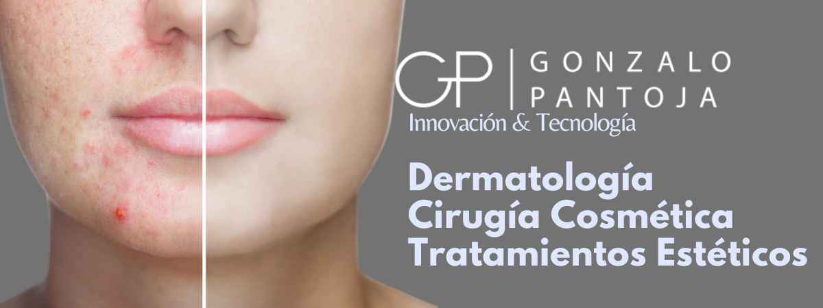 Dermatología GP GONZALO PANTOJA