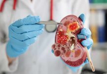 Prestigiosa revista científica publicó trabajo de nefrólogos Chilenos