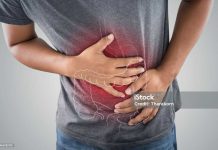 Prevención es crucial para evitar el cáncer de colon Prevención es crucial para evitar el cáncer de colon