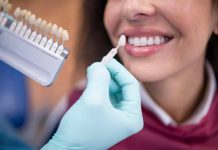 Blanqueamiento dental: expertos advierten riesgos de hacerlo sin indicación médica Blanqueamiento dental: expertos advierten riesgos de hacerlo sin indicación médica