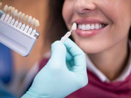 Blanqueamiento dental: expertos advierten riesgos de hacerlo sin indicación médica