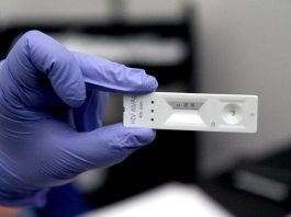 Autotesteo de VIH: lo que necesitas saber antes de hacerte uno Autotesteo de VIH: lo que necesitas saber antes de hacerte uno
