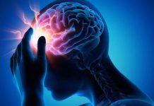 Encefalitis: Experto de Mayo Clinic explica por qué es importante el tratamiento temprano Encefalitis: Experto de Mayo Clinic explica por qué es importante el tratamiento temprano