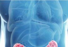 https://portalprensasalud.cl/2024/03/26/incremento-de-cancer-colorrectal-preocupa-a-expertos-chileno/