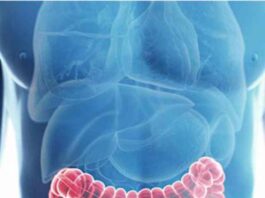 Incremento de cáncer colorrectal preocupa a expertos chileno https://portalprensasalud.cl/2024/03/26/incremento-de-cancer-colorrectal-preocupa-a-expertos-chileno/