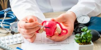 Día Mundial del Cáncer Cérvico Uterino: cáncer cérvico uterino podría no presentar síntomas al comienzo