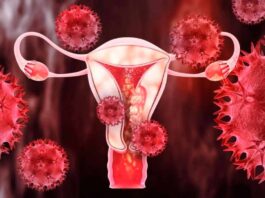 Científicos de Mayo desarrollan pruebas caseras con hisopo para cánceres de endometrio y ovario Científicos de Mayo desarrollan pruebas caseras con hisopo para cánceres de endometrio y ovario