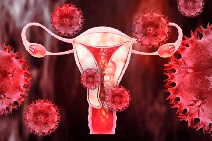 Científicos de Mayo desarrollan pruebas caseras con hisopo para cánceres de endometrio y ovario