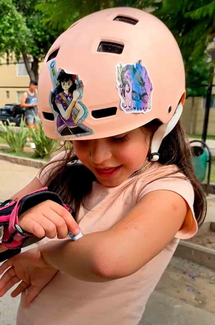 Cicatrices en niños: ¿Cómo tratarlas?