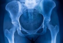 Fundación AMCI promueve «Cadera 360º»: Primer curso integral de cadera y pelvis para residentes Fundación AMCI promueve "Cadera 360º": Primer curso integral de cadera y pelvis para residentes
