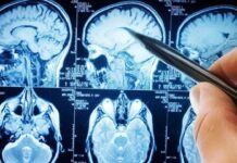 Día Mundial de la Esclerosis Lateral Amiotrófica: Cómo es y cuáles son los síntomas de la enfermedad que padecía Stephen Hawking