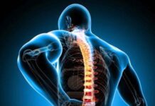 El largo camino del diagnóstico de las Espondilitis en Chile