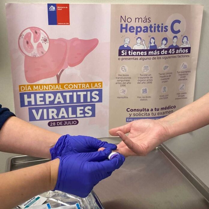 Hepatitis en Chile: Agrupación de hepatólogos refuerza tamizaje en embarazadas y población de riesgo