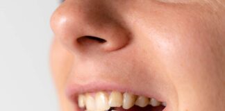 Ortodoncia lingual, la solución definitiva para problemas dentales complejos