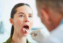Tabaco, mala higiene dental y VPH: factores que incrementan el riesgo de cáncer de cabeza y cuello Tabaco, mala higiene dental y VPH: factores que incrementan el riesgo de cáncer de cabeza y cuello