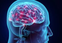 La importancia de la prevención y detección temprana de enfermedades neurodegenerativas La importancia de la prevención y detección temprana de enfermedades neurodegenerativas