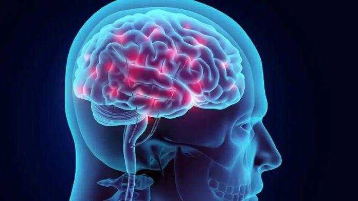 cerebro ok (1) La importancia de la detección temprana de una de las enfermedades con mayor mortalidad en Chile