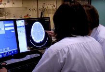 Día Mundial del Accidente Cerebrovascular: el método para identificar síntomas de un ACV de forma temprana 