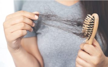 Alopecia femenina: una condición que afectará a una de cada cuatro mujeres en algún momento de su vida